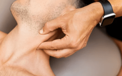 Trigger Point Therapy: How It Relieves Muscle Knots and Chronic Pain