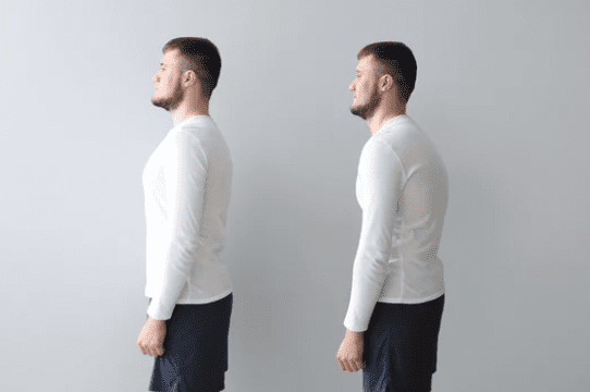 Postural Imbalance: Why It Happens and How to Restore Alignment