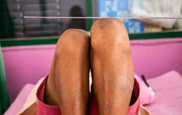 How Massage Can Rebalance Muscle Tension from Leg Length Discrepancy