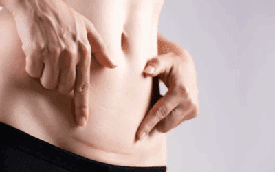 Unlocking the Power of Winback Tecar Therapy for Scar Tissue and Pain Relief in Slough